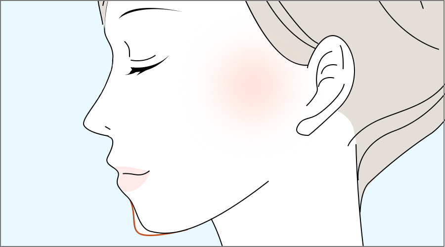 シャープな顎で理想のEライン・小顔効果も