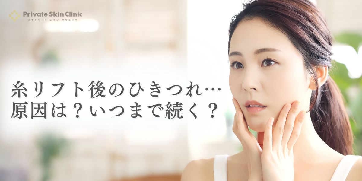 糸リフト後のひきつれの原因は？