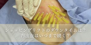 ショッピングリフトのダウンタイムについて解説します！