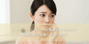 レーザートーニングの効果はいつから？肝斑治療で後悔しないために