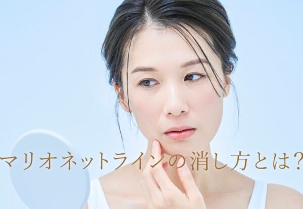 マリオネットライン　消し方